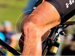 Ärzte und orthopäden werden nicht müde, vor allem die schonung der gelenke beim fahrradfahren hervorzuheben. Knie