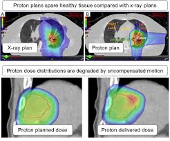 magnetic resonance imaging mri guided