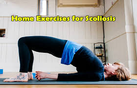 scoliosis exercises 4 most amazing