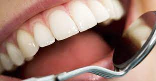 The short answer is that tooth filling costs anywhere between $115 and $285 according to a recent ada survey. How Much Does A Cavity Filling Typically Cost Without Dental Insurance Best Dental Tips