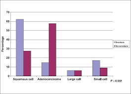 Distribution Of Lung Cancer Patients By Histopathology And