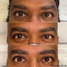 eyebrow procedures microblading ombré