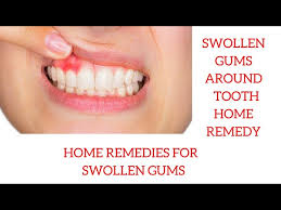 swollen gums around tooth home remedy
