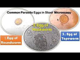 roundworm tapeworm and hookworm eggs