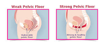 pelvic floor with biofeedback