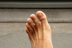 second toe pain possible causes