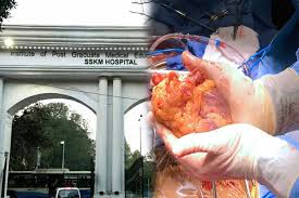 Die angegebenen daten werden ausschließlich zur darstellung der. Looking Back Today Sskm Hospital Created History With First Heart Transplant