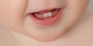 6 das nachwachsen der bleibenden zähne. Wie Viele Milchzahne Hat Ein Kind Die Antwort Desired De