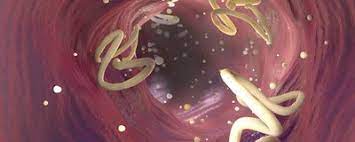 intestinal worms inspire new