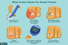 when to seek treatment for toenail trauma