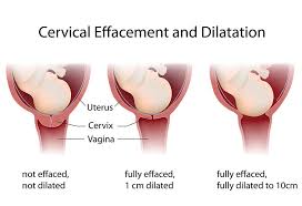 dilation of cervix during labour delivery