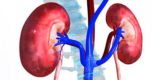 Image result for kidney failure