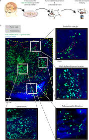 Intravital Imaging Of Glioma Border Morphology Reveals