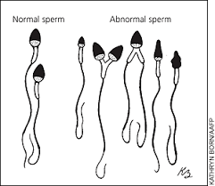 Image result for bentuk sperma