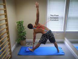 yoga exercises good for scoliosis