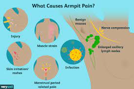 armpit pain common causes diagnosis