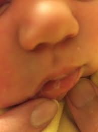 lips of four week old newborn pic
