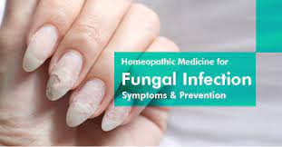 homeopathic cine for fungal