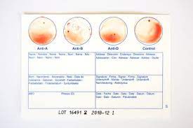 home blood type test