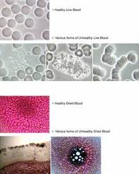 14 Best Live And Dry Blood Microscopy Images Blood Blood