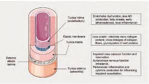 Vascular Age How Can It Be Determined What Are Its