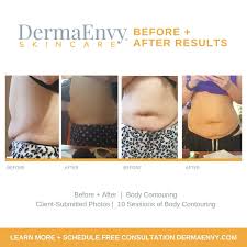 body contouring sculpting treatments