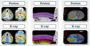 what is proton therapy chang g