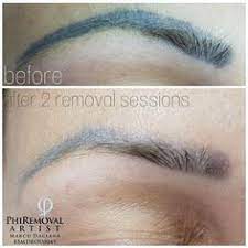 Most eyebrow tattoos are small, and most small tattoos require only one minute under the laser per session. 29 Eyebrows Removal Ideas Eyebrows How To Remove Skin Healing