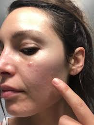 How many products do you have to use? I Tried Jennifer Lopez S Skincare Routine For 6 Weeks And Here S What Happened To My Skin