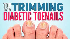 diabetic nails toenails how to trim
