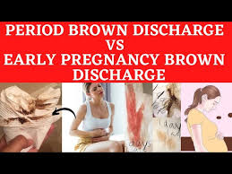 early pregnancy brown discharge