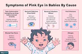 pink eye in es causes symptoms