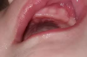 Im durchschnitt beginnen ab dem sechsten lebensmonat die ersten zähne schubweise durchzubrechen. Kommt Da Ein Zahn Bei Meinem Baby Durch Gesundheit Und Medizin Zahnen
