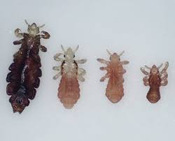 gwin oaks elementary lice