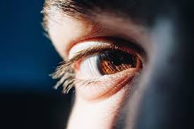 eye discharge causes and how to stop