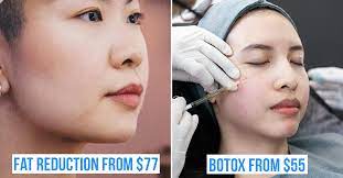8 korean beauty treatments to do the
