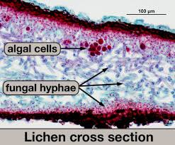 Image result for crustose lichen microscope