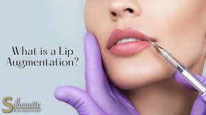 what is a lip augmentation