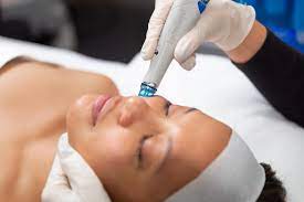 I Tried a HydraFacial, and My Skin Will Never Be the Same Again – The  Clinic Bondi