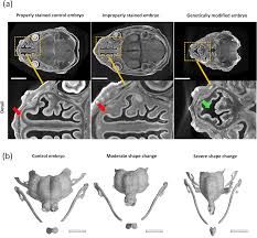 resolving complex cartilage structures