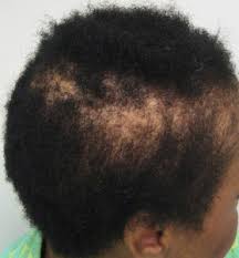 First the thio based chemical is applied to remove the natural curl then rinsed off. 9 Reasons To Avoid Perms And Relaxers Black Liberation Love Of N Unity