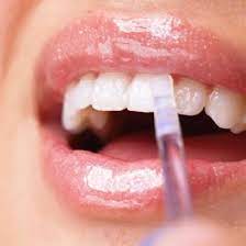 4ml instant teeth whitening stick
