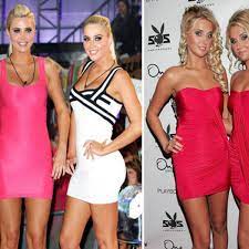 Shannon twins before and after