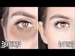 remove dark circles naturally overnight