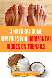 horizontal ridges on toenails causes