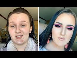 make up artist with severe acne shares