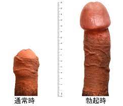 File:Comparison of flaccid and erected penis.jpg - Wikimedia Commons