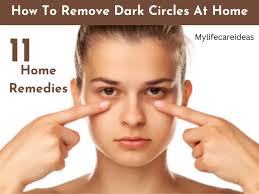 how to remove dark circles at home 11
