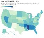 Mississippi has the country's highest rate of stillbirths