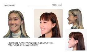 jaw surgery and orthodontic treatment